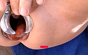 Extreme Anal Fisting for My Loose Sloppy Asshole